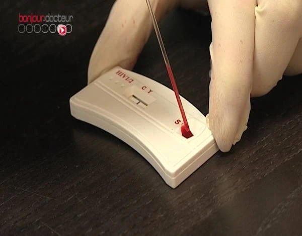 Pháp cho phép lưu hành sản phẩm tự xét nghiệm HIV từ năm 2014